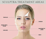 Sculptra® 童颜针治疗部位示意图（模特面部区域标注，仅供示意）