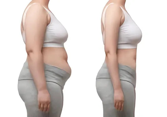 Wegovy Weight Loss Treatment - MY TIMELESS