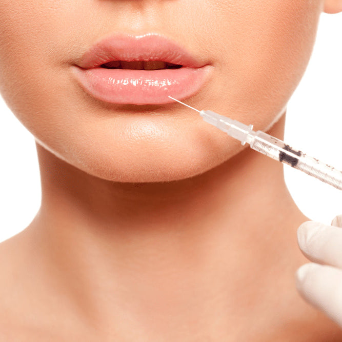 Lip enhancement - MY TIMELESS