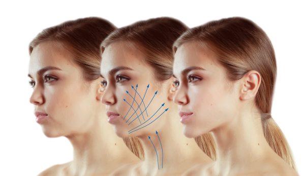 Full Face Contouring and Lifting (Injectable Thermage) - MY TIMELESS
